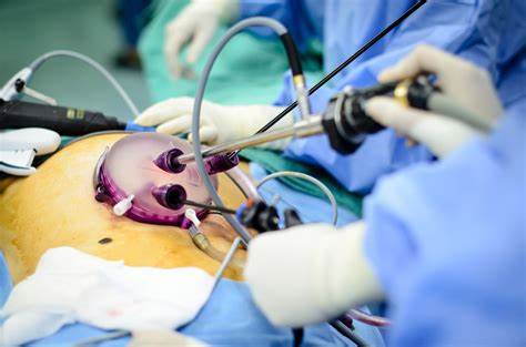 General Surgery & Laparoscopy